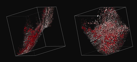 Multiphoton Microscopy